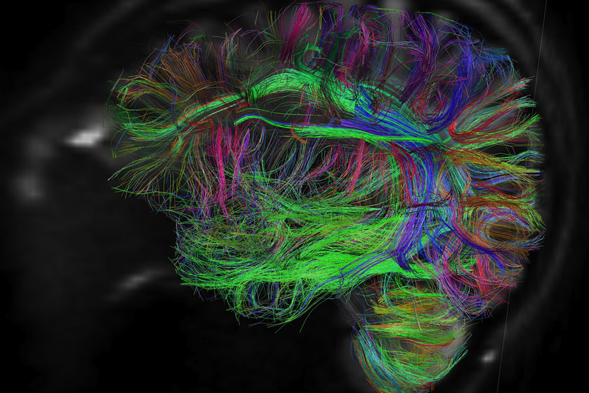 brain active 4