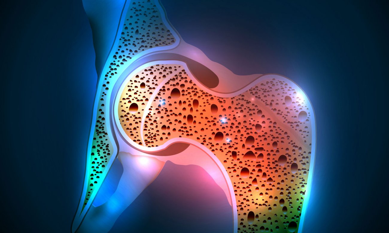 osteoporosis yogurt 1