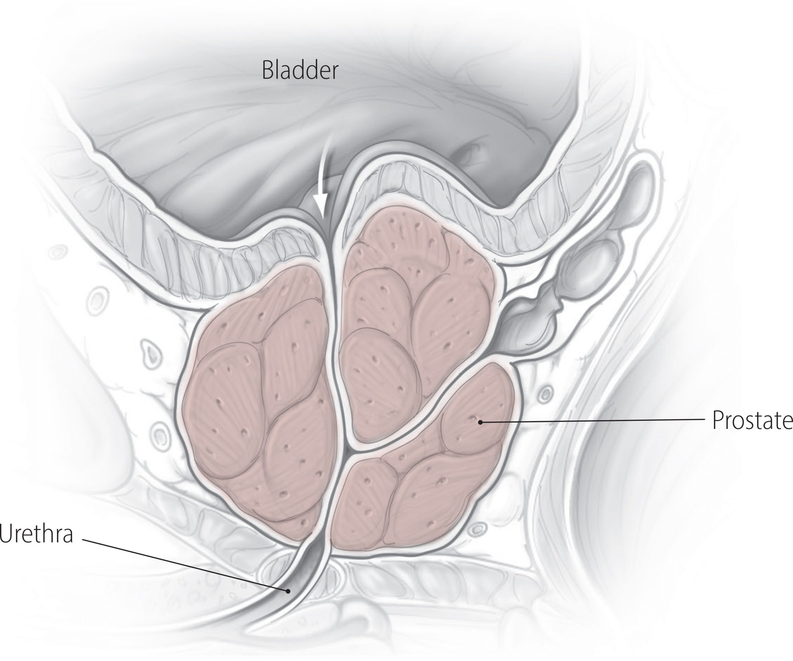 urinary 5