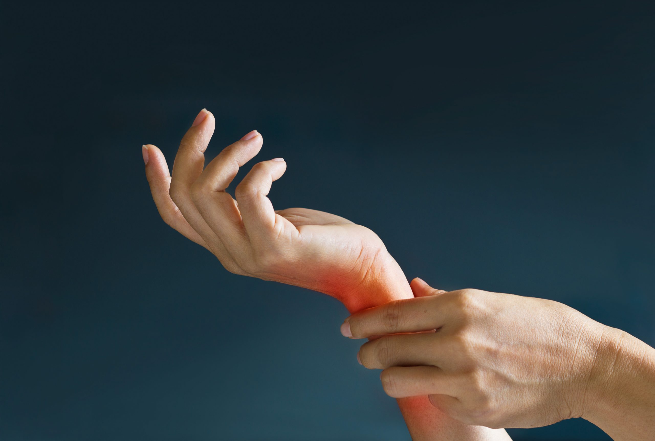 psoriasis 5