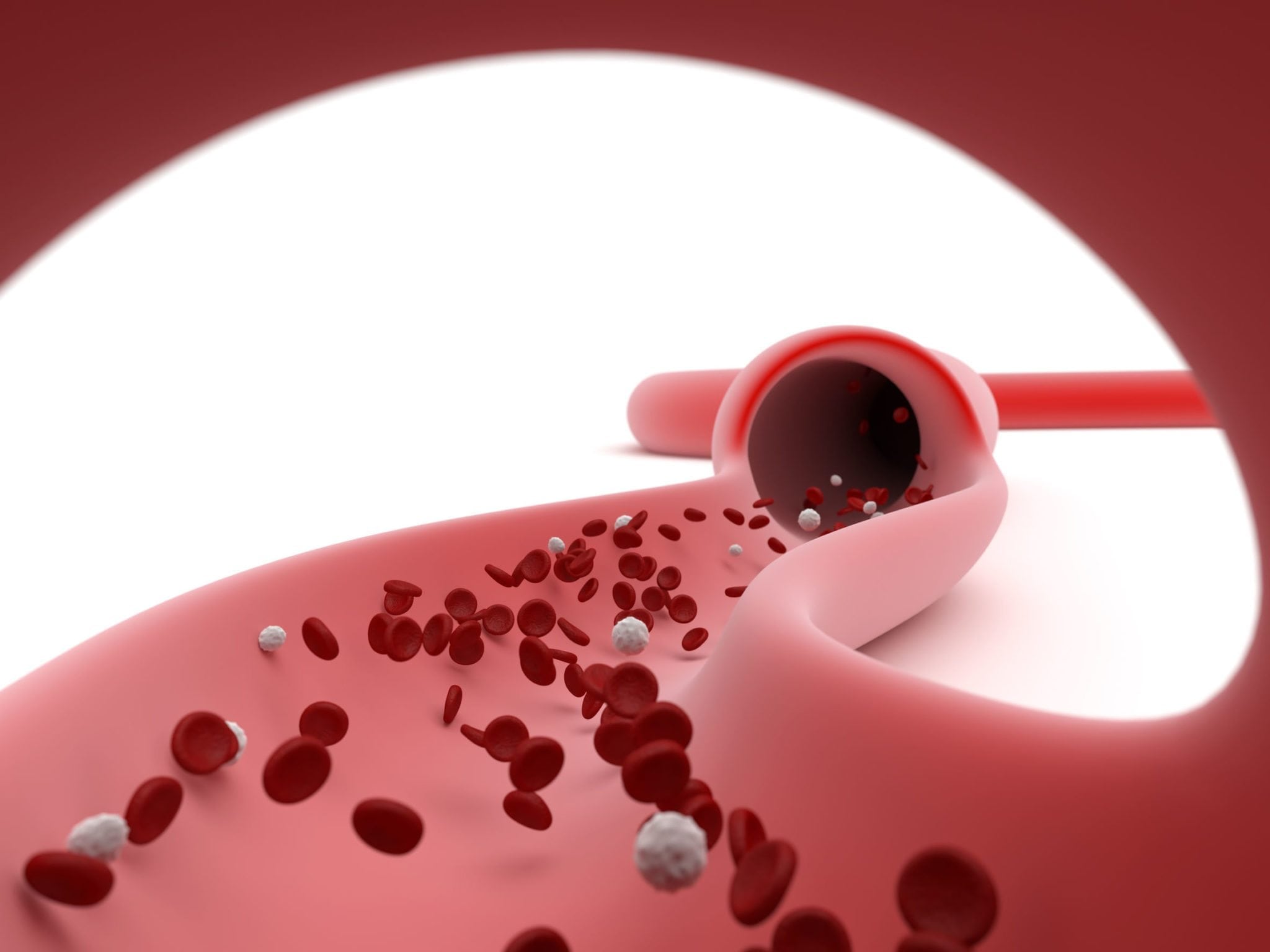 idiopathis thrombopeniki porfira 3