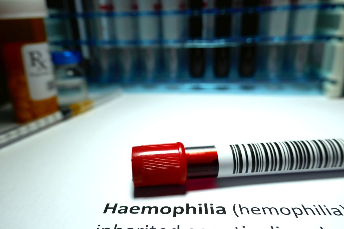 Haemophilia
