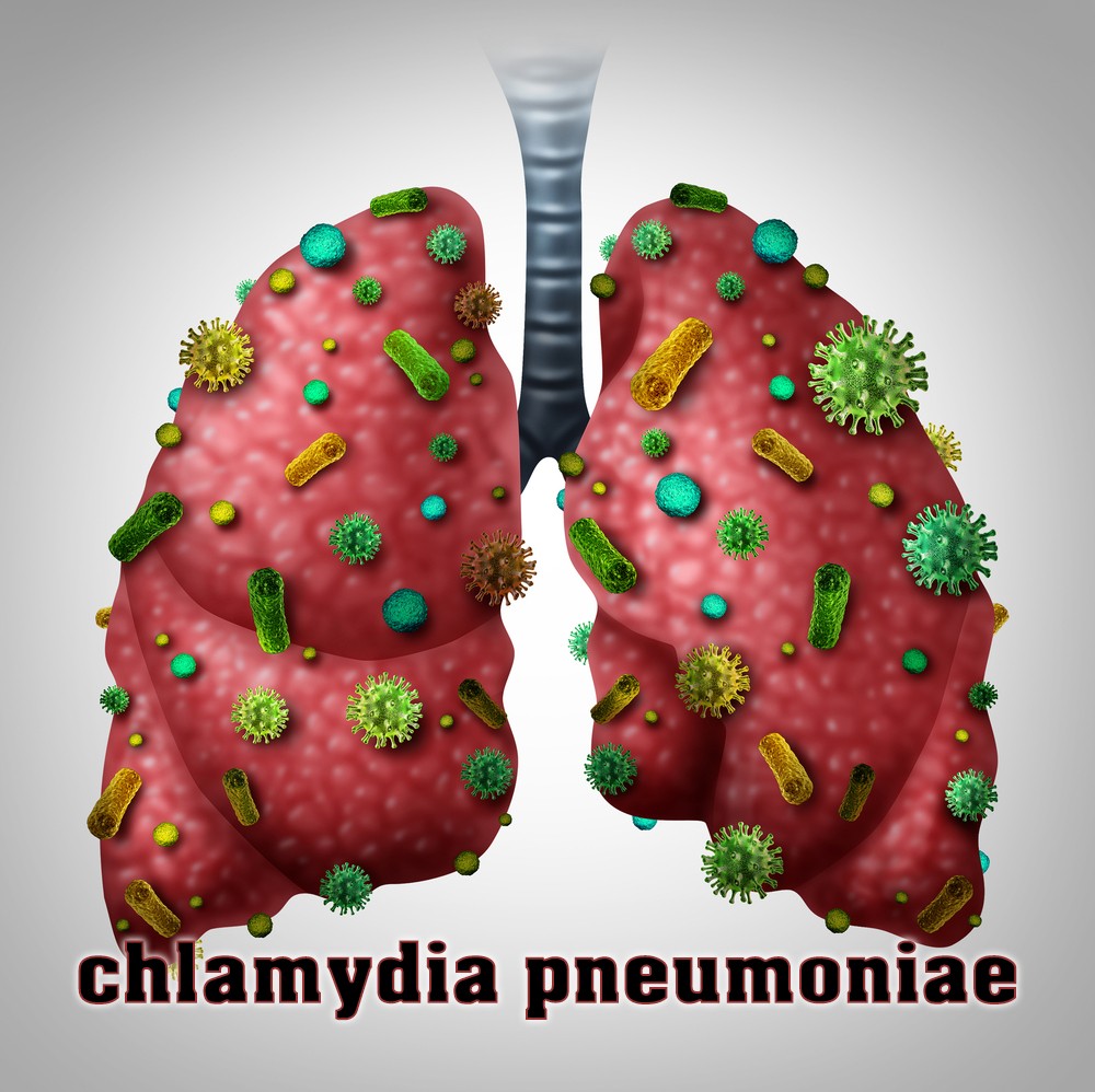 chlamydia pneumoniae