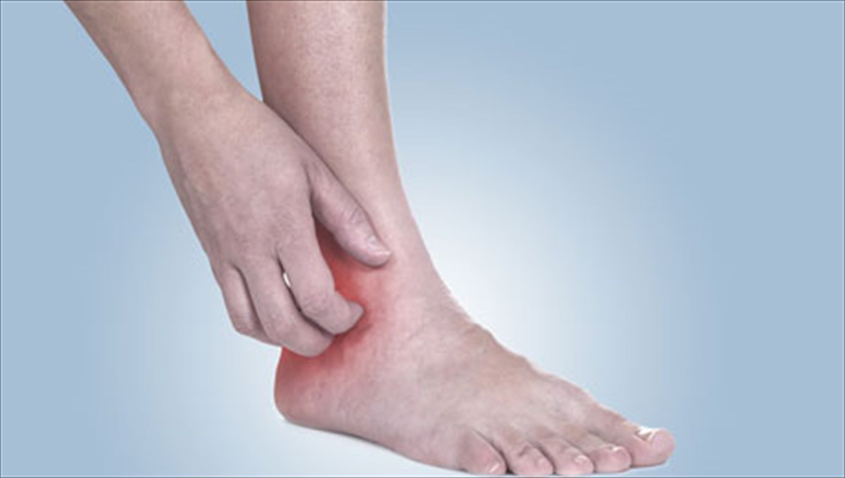 4 therapeies tis fusis gia tis allergies kai ti fagoura therapeies tis fusis gia tis allergies kai ti fagoura