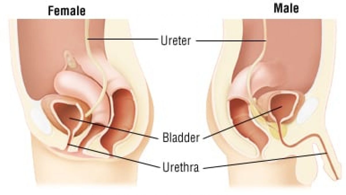 Urethritis 1200x675