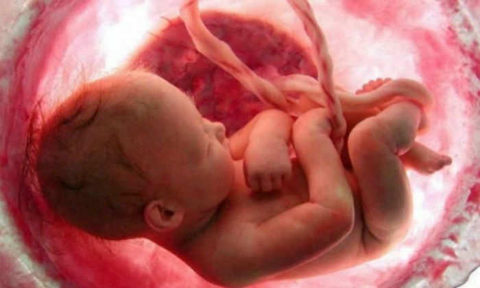 12ac5f9cd9a36778268af59027f19f9e L