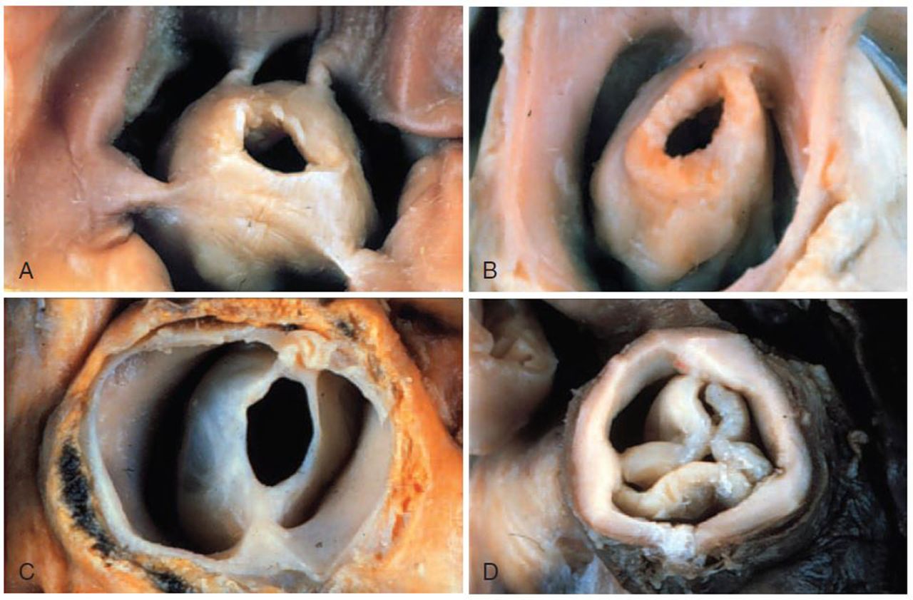 heartjnl 2019 March 105 5 414 F1.large