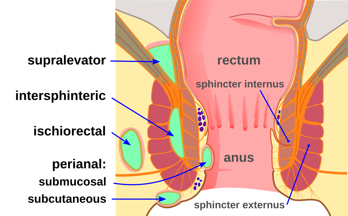 rectal abs 1