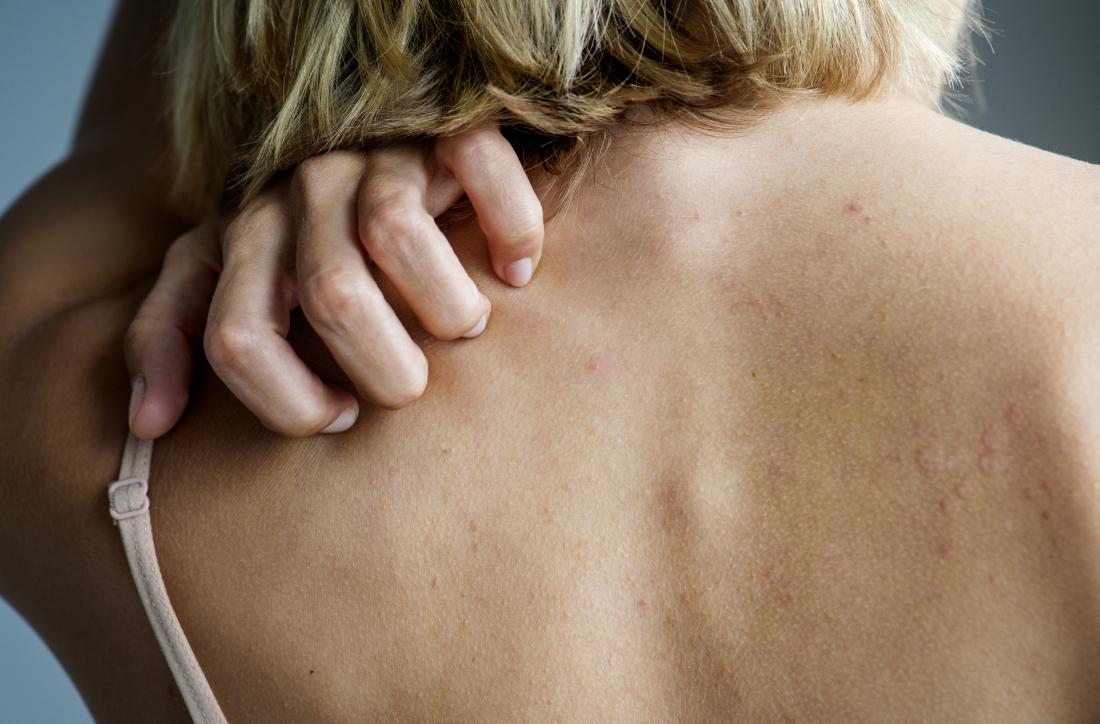 woman scratching her back