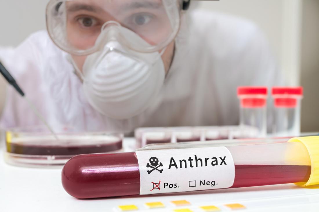 anthrax infection is not common in the united states