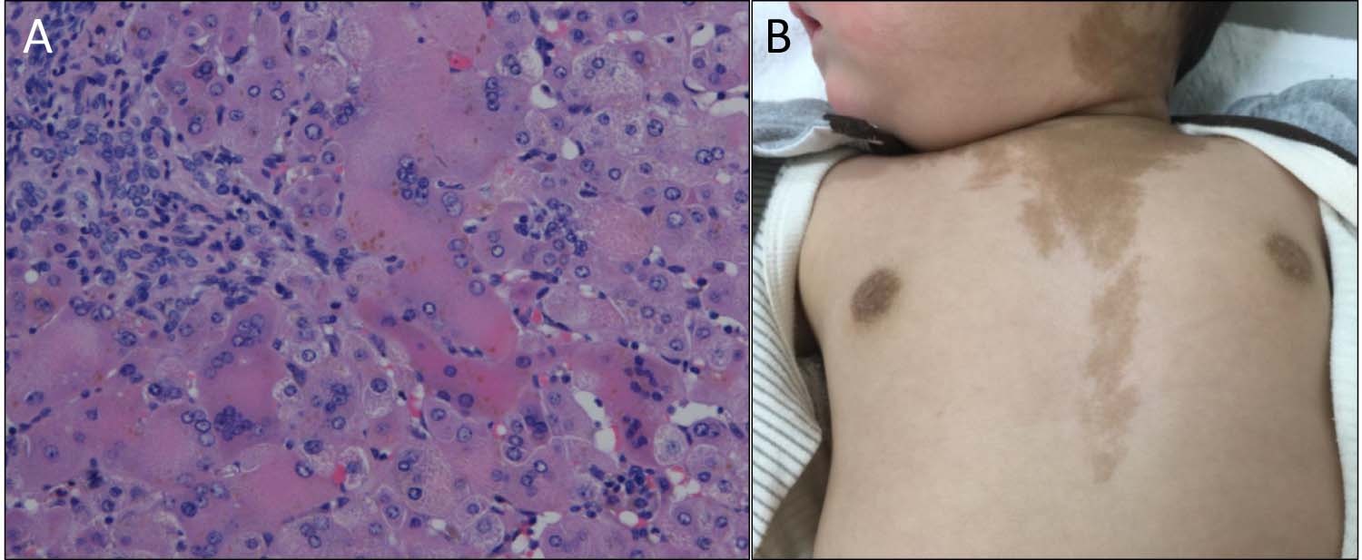 ympd8566 fig 0001 lrg